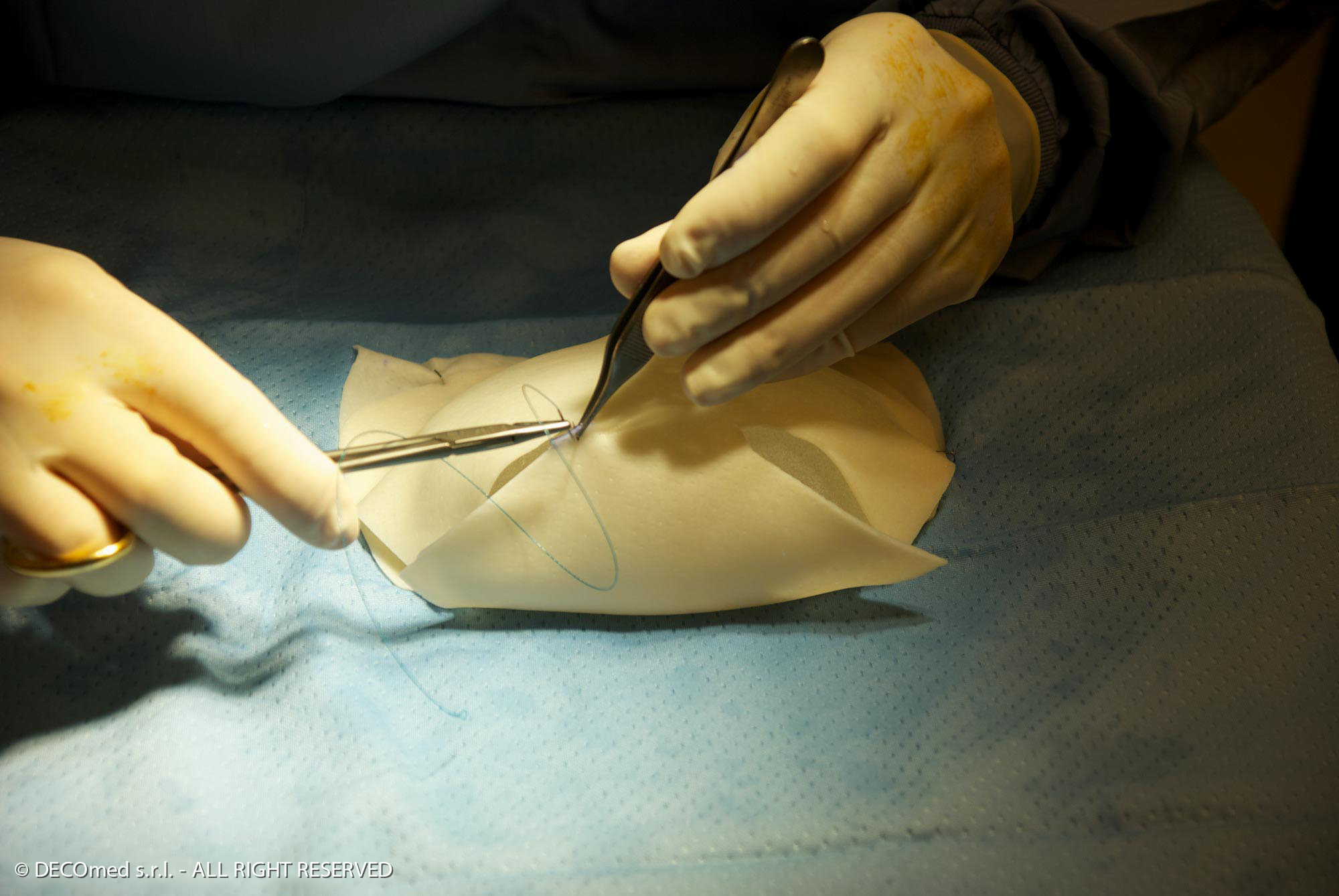 Braxon - QuaMedical Medische oplossingen voor de Reconstructieve Chirurgie